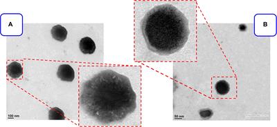 Liposomal Delivery of Mycophenolic Acid With Quercetin for Improved Breast Cancer Therapy in SD Rats